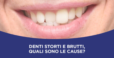 Denti storti e brutti, quali sono le cause