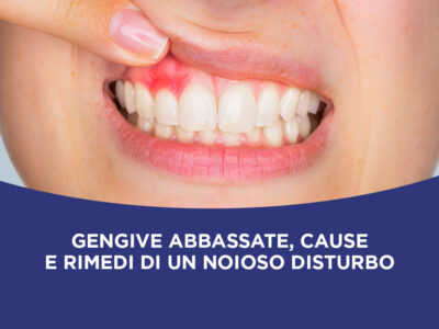 Gengive abbassate cause e rimedi