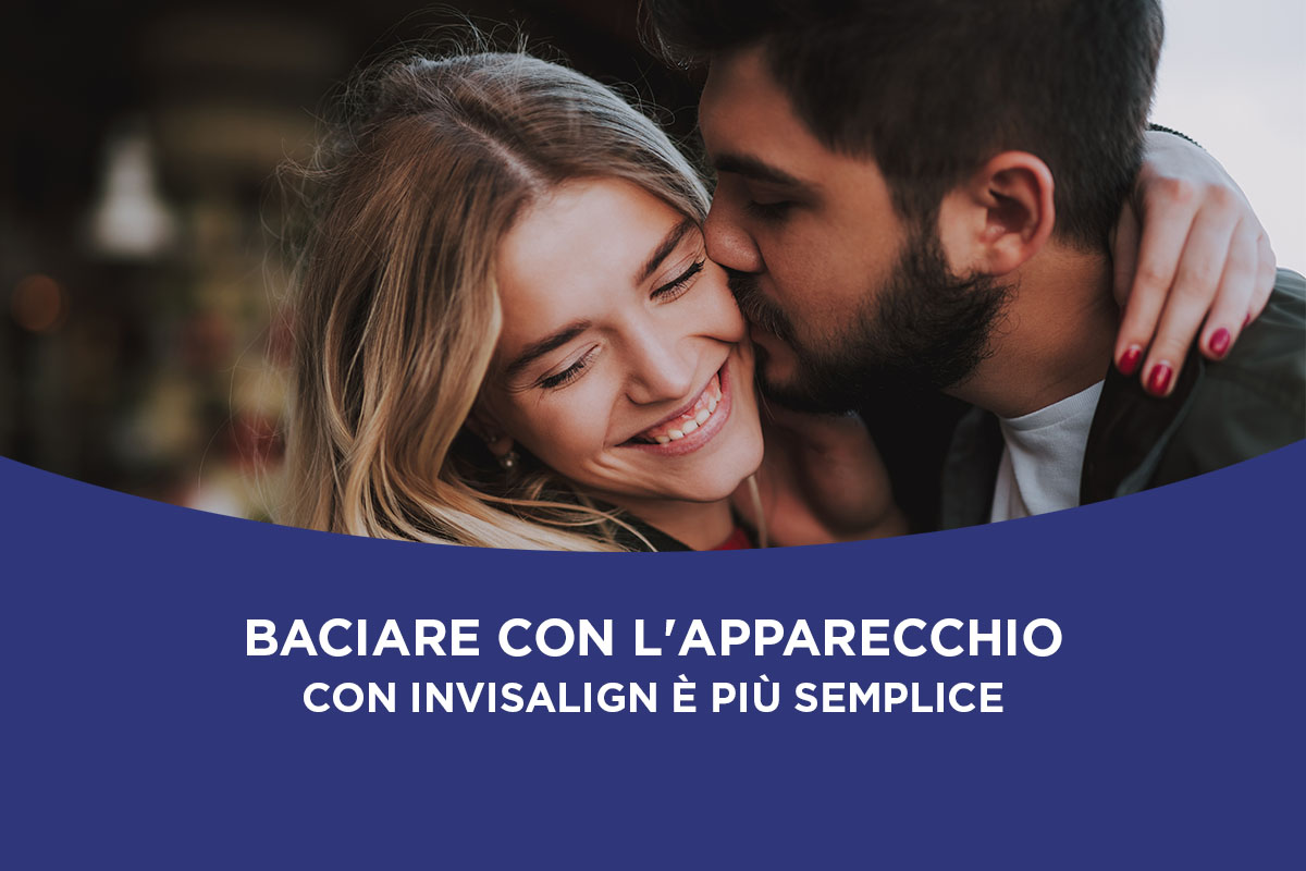 Si può baciare con l'apparecchio? Con Invisalign è più semplice