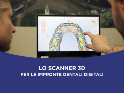 Scanner 3D impronte dentali digitali