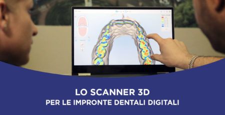 Scanner 3D impronte dentali digitali