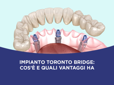 Impianto Toronto Bridge a Milano