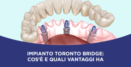 Impianto Toronto Bridge a Milano